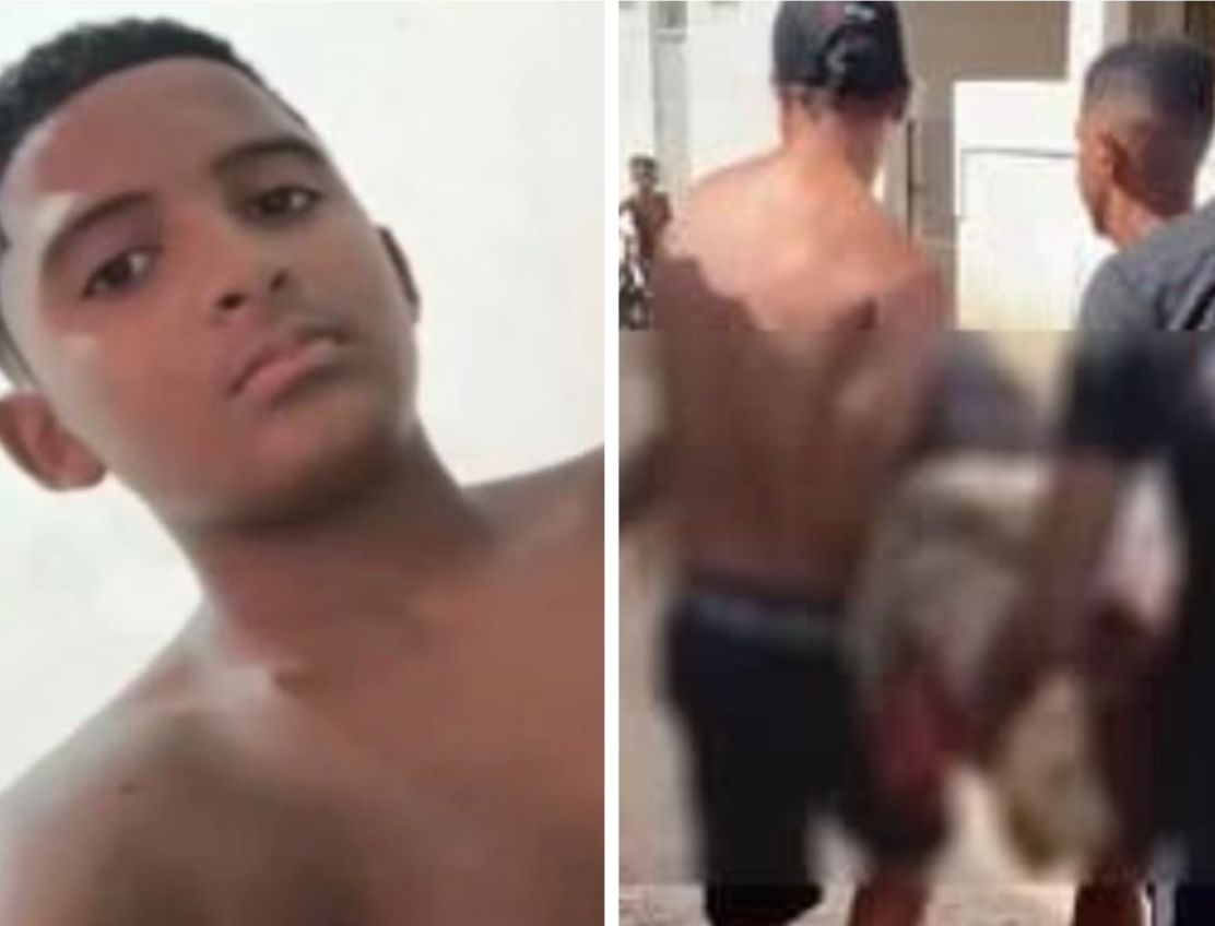 adolescente-morre-em-olinda-(pe)-apos-mordida-de-tubarao