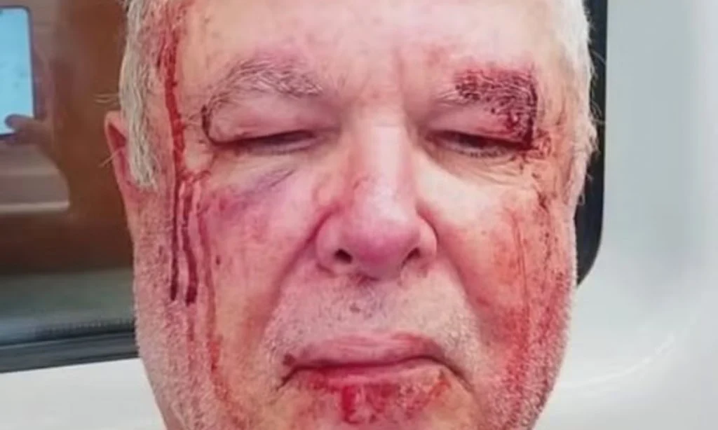 ‘foi-uma-tentativa-de-homicidio’,-diz-eleitor-do-pt-agredido-em-copacabana