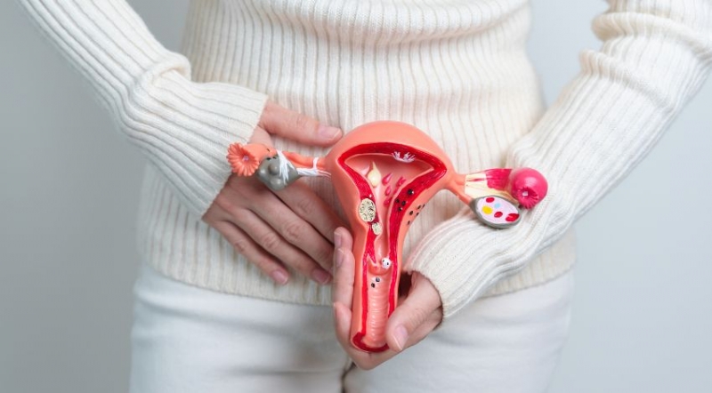 planos-de-saude-passam-a-cobrir-diu-hormonal-contra-endometriose