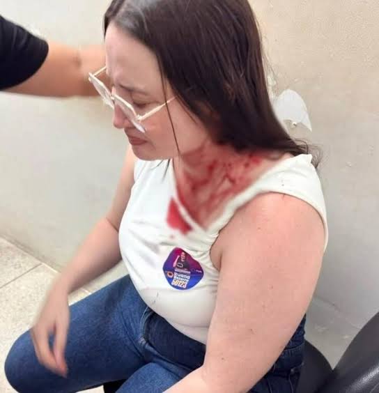 ruana-bezerra-e-atingida-por-pedrada-durante-campanha-em-ouricuri